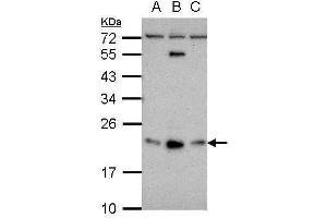 WB Image Sample (30 ug of whole cell lysate) A: NT2D1 B: PC-3 C: U87-MG 12% SDS PAGE antibody diluted at 1:500