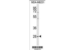 Image no. 1 for anti-Yip1 Domain Family, Member 5 (YIPF5) (AA 21-49), (N-Term) antibody (ABIN653506)