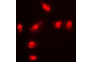 Image no. 1 for anti-Forkhead Box O1 (FOXO1) (pSer256) antibody (ABIN2957579)