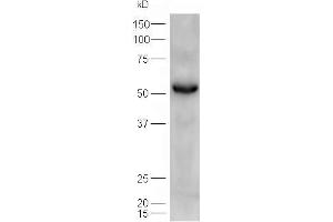 Image no. 1 for anti-Patatin-Like phospholipase Domain Containing 2 (PNPLA2) (AA 401-504) antibody (ABIN704756)