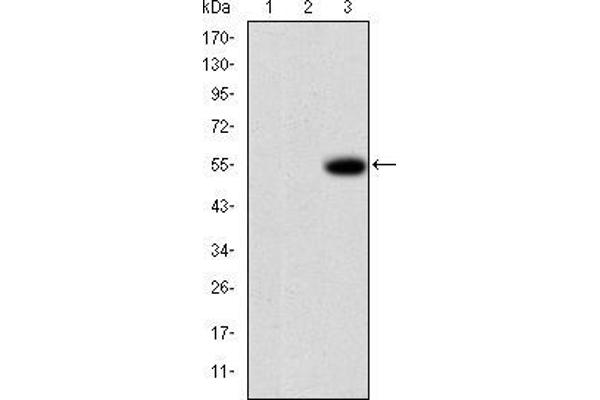 MMP 9 antibody