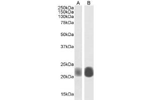 Image no. 2 for anti-Caveolin 1, Caveolae Protein, 22kDa (CAV1) (Internal Region) antibody (ABIN185421)
