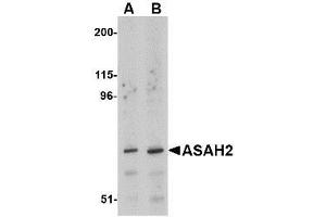 Image no. 1 for anti-N-Acylsphingosine Amidohydrolase (Non-Lysosomal Ceramidase) 2 (ASAH2) (C-Term) antibody (ABIN499341)