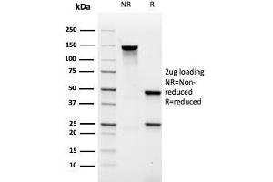 Image no. 1 for anti-Mucosa Associated Lymphoid Tissue Lymphoma Translocation Gene 1 (MALT1) (AA 701-808) antibody (ABIN6939112)
