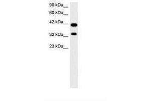 Image no. 2 for anti-Paired Box Gene 2a (PAX2A) (AA 174-223) antibody (ABIN202997)