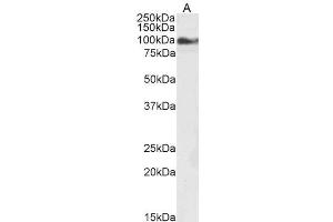 Image no. 2 for anti-Transient Receptor Potential Cation Channel, Subfamily C, Member 6 (TRPC6) (C-Term) antibody (ABIN185460)