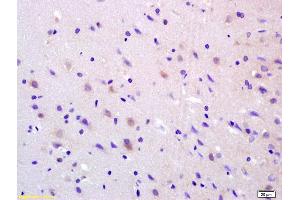 Image no. 2 for anti-Adenylate Cyclase 8 (Brain) (ADCY8) (AA 151-250) antibody (ABIN751228)