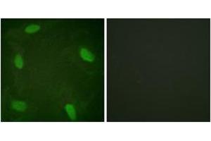 Immunofluorescence analysis of HeLa cells treated with Forskolin 40nM 30', using SSB (Phospho-Ser366) Antibody.