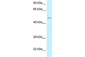 Image no. 1 for anti-erythrocyte Membrane Protein Band 4.9 (Dematin) (EPB49) (Middle Region) antibody (ABIN2788873)