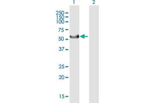 anti-Keratin 39 (KRT39) (AA 1-491) antibody
