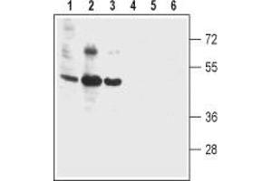 anti-Bestrophin 2 (BEST2) (3rd Extracellular Loop), (AA 259-270) antibody