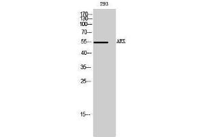 Image no. 1 for anti-Aristaless Related Homeobox (ARX) (Internal Region) antibody (ABIN3180497)