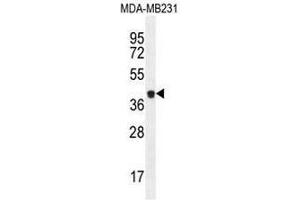 Image no. 2 for anti-Caspase 5, Apoptosis-Related Cysteine Peptidase (CASP5) (AA 146-175), (Middle Region) antibody (ABIN951054)