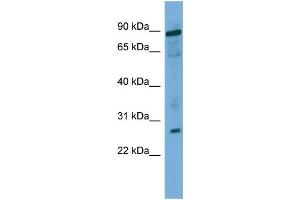 Image no. 1 for anti-Ubiquitin-Conjugating Enzyme E2F (UBE2F) (Middle Region) antibody (ABIN2784962)