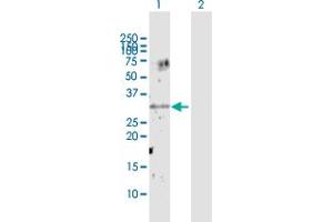 Image no. 2 for anti-Unc-119 Homolog (UNC119) (AA 1-240) antibody (ABIN522531)