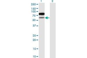 Image no. 1 for anti-tRNA Methyltransferase 2 Homolog A (TRMT2A) (AA 1-625) antibody (ABIN525815)