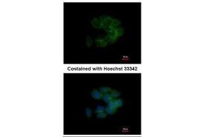 Image no. 2 for anti-CDC42 Binding Protein Kinase alpha (DMPK-Like) (CDC42BPA) (Center) antibody (ABIN2855436)