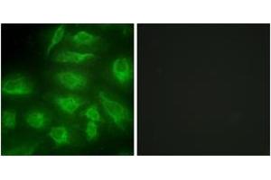 Image no. 2 for anti-Diacylglycerol Kinase, iota (DGKI) (AA 991-1040) antibody (ABIN1533547)