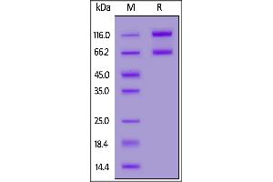 Image no. 2 for IL-2 R beta & IL-2 R alpha & IL-2 R gamma (AA 22-212), (AA 23-254), (AA 27-239) (Active) protein (Fc Tag,AVI tag,Biotin) (ABIN6973114)