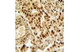 Image no. 3 for anti-Histone Deacetylase 2 (HDAC2) (AA 417-447), (Middle Region) antibody (ABIN952698)