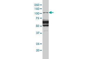 Image no. 2 for anti-RAS P21 Protein Activator (GTPase Activating Protein) 1 (RASA1) (AA 948-1047) antibody (ABIN562592)