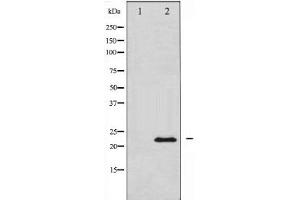 Image no. 2 for anti-Vascular Endothelial Growth Factor B (VEGFB) antibody (ABIN6269454)