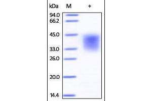 Image no. 2 for Leukemia Inhibitory Factor (LIF) (AA 23-202) (Active) protein (ABIN2181462)
