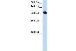 Image no. 1 for anti-Splicing Factor, Suppressor of White-Apricot Homolog (SFSWAP) antibody (ABIN633458)