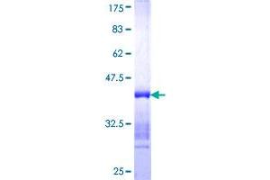 NOC3L Protein (AA 702-800) (GST tag)