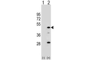 Image no. 3 for anti-Arylacetamide Deacetylase (Esterase) (AADAC) (AA 273-300) antibody (ABIN5647317)