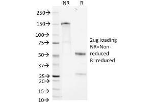 Image no. 1 for anti-Heparan Sulfate Proteoglycan 2 (HSPG2) antibody (ABIN6939672)