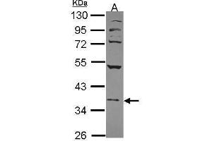 anti-Nuclear Factor (Erythroid-Derived 2), 45kDa (NFE2) (Center) antibody