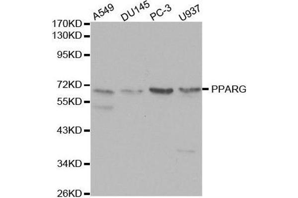 PPARG 抗体  (AA 50-150)