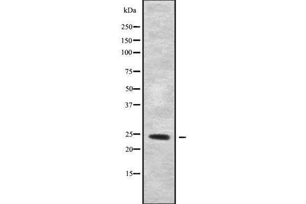 Claudin 20 antibody  (C-Term)