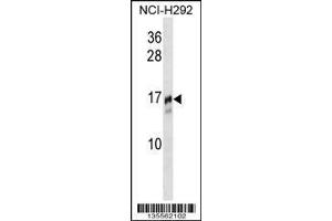 Image no. 1 for anti-Trafficking Protein Particle Complex 2 (TRAPPC2) (AA 11-39), (N-Term) antibody (ABIN1538917)
