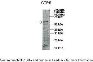 Image no. 4 for anti-CTP Synthase (CTPS) (N-Term) antibody (ABIN2782465)