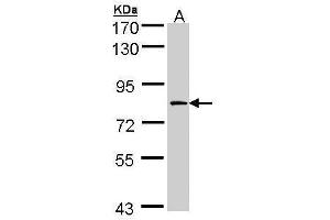 Image no. 1 for anti-Coagulation Factor XIII, A1 Polypeptide (F13A1) (N-Term) antibody (ABIN2856753)