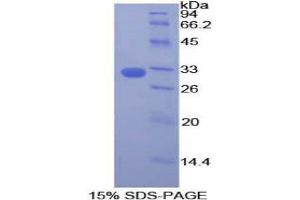 Image no. 1 for Dedicator of Cytokinesis 1 (DOCK1) (AA 1200-1435) protein (His tag) (ABIN1878348)