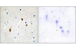 Image no. 1 for anti-Hairless (HR) (AA 41-90) antibody (ABIN1533510)