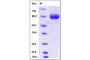 Image no. 1 for Roundabout, Axon Guidance Receptor, Homolog 4 (ROBO4) (AA 1-480) protein (His tag) (ABIN2008574)