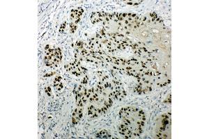 Image no. 5 for anti-Tumor Protein P63 (TP63) (AA 664-680), (C-Term) antibody (ABIN3044067)
