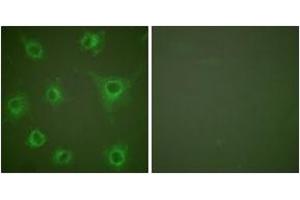 Image no. 1 for anti-Collagen, Type II (COL2) (AA 101-150) antibody (ABIN1533237)