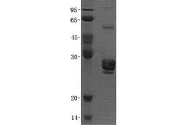 PAFAH1B2 Protein (Transcript Variant 2) (His tag)