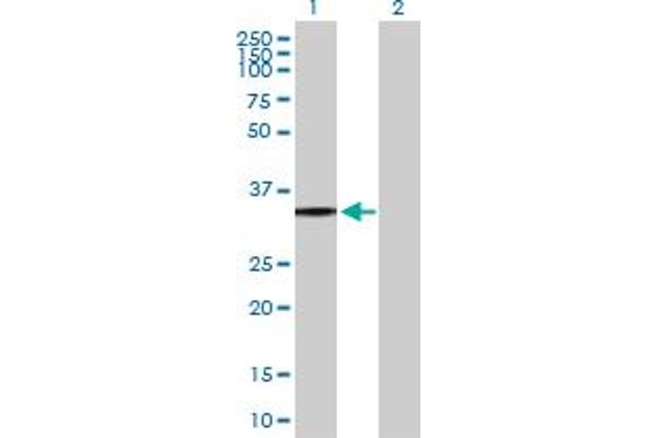 anti-Purinergic Receptor P2Y, G-Protein Coupled, 8 (P2RY8) (AA 1-359) antibody