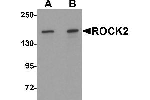 Western blot analysis of ROCK2 in mouse brain tissue lysate with ROCK2 antibody at (A) 1 and (B) 2 µg/mL