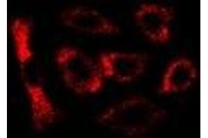 Image no. 3 for anti-Microtubule-Associated Protein 1 Light Chain 3 beta (MAP1LC3B) antibody (ABIN3198184)