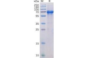 Human OX40 Protein, hFc-His Tag on SDS-PAGE under reducing condition.