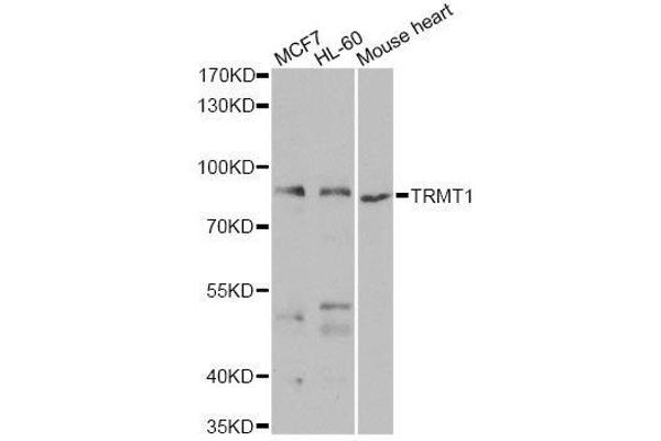 TRMT1 抗体  (AA 460-659)