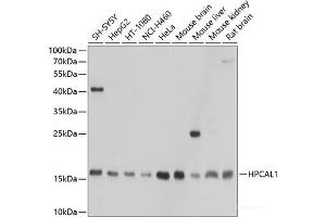 Western blot analysis of extracts of various cell lines using HPCAL1 Polyclonal Antibody at dilution of 1:1000.