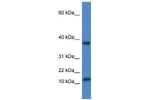 Image no. 1 for anti-Vesicle-Associated Membrane Protein 1 (Synaptobrevin 1) (VAMP1) (Middle Region) antibody (ABIN929250)